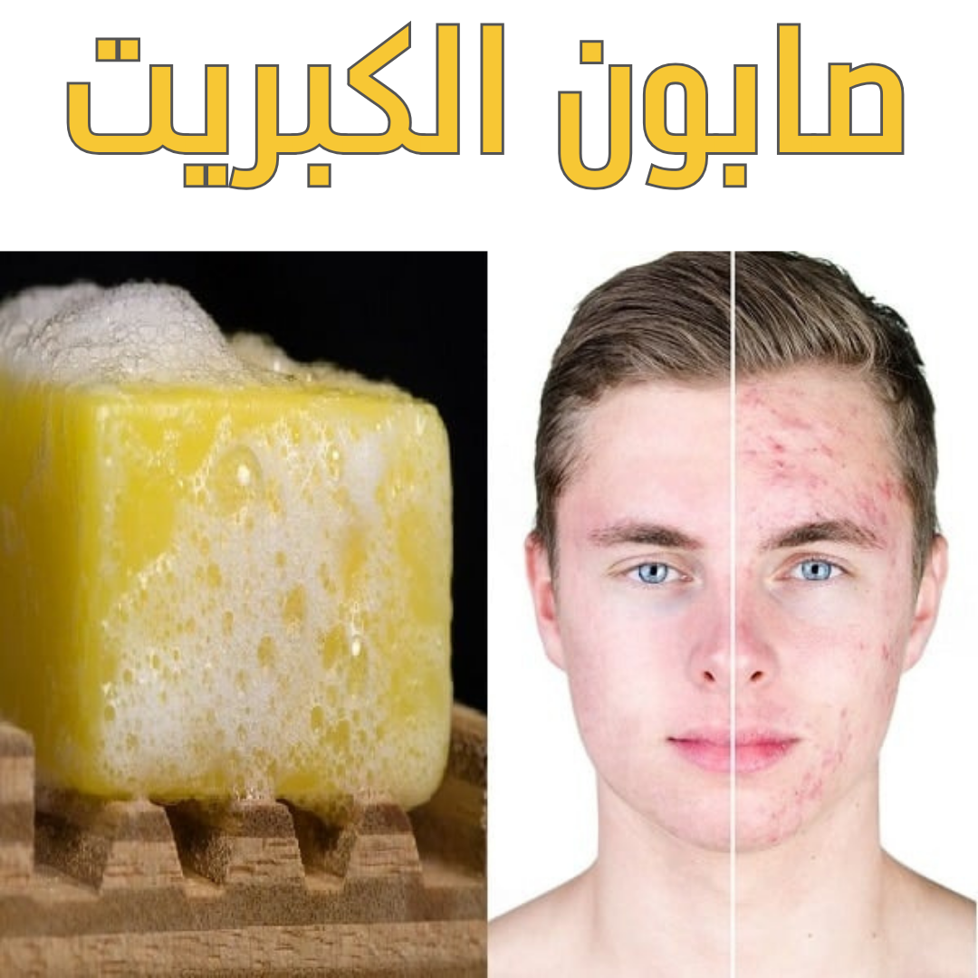  صابون الكبريت  